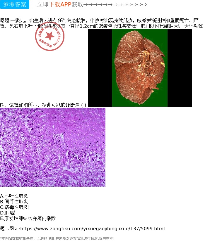 肺结核是严重的病吗-肺结核的危害与传播途径，你了解多少？