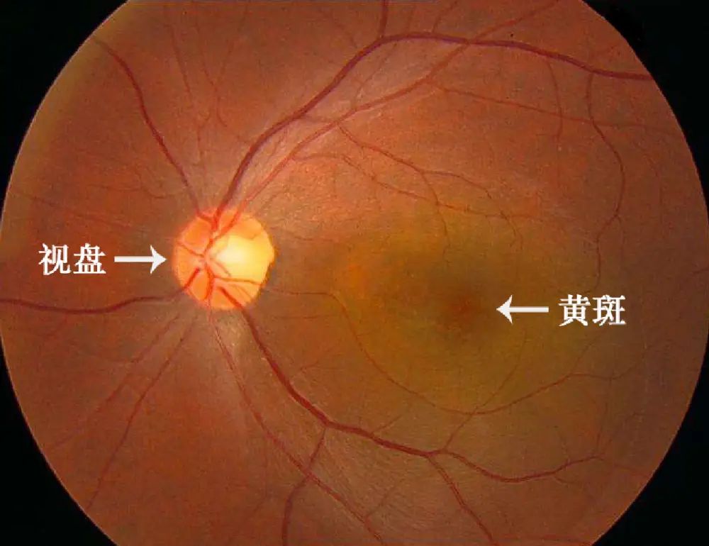 白眼球发蓝是什么_白眼球发蓝是怎么回事_眼球回事白发蓝是怎么回事